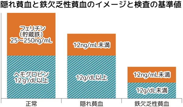 隠れ貧血と鉄欠乏性貧血のイメージと検査の基準値。正常 フィリチン(貯蔵鉄)25~250ng/mL、ヘモグロビン12g/dL以上。隠れ貧血 フィリチン(貯蔵鉄)12ng/mL未満、ヘモグロビン12g/dL以上。鉄欠乏性貧血 フィリチン(貯蔵鉄)12ng/mL未満、ヘモグロビン12g/dL未満